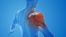 top causes of muscle pain