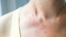 shingles