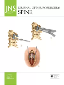 Journal of neurosurgery Spine